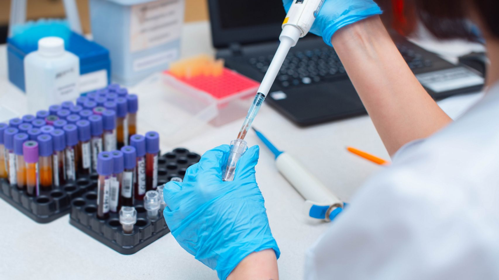 Etapa preanalítica - Control de calidad en laboratorio de bioquimica clinica